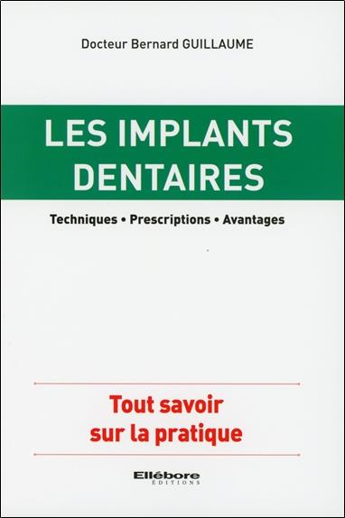 Les implants dentaires - Techniques - Prescriptions - Avantages