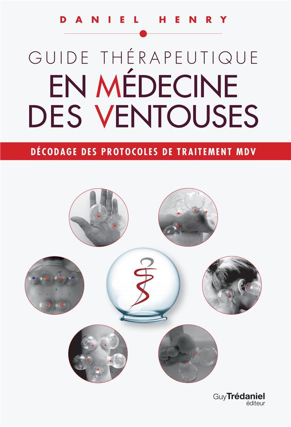 Guide Thérapeutique en Médecine des Ventouses, T3